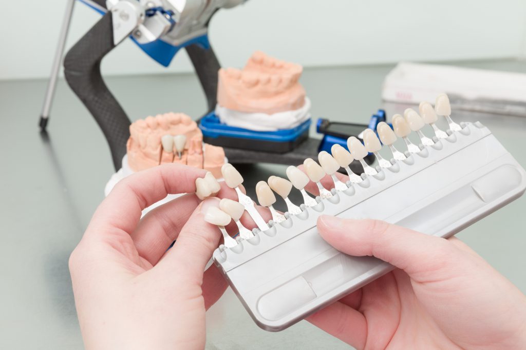Dentist's Hand With Shade Guide To Check Veneer Of Tooth Crown In A Dental Laboratory