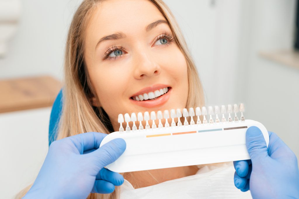 Choosing A Shade Of Dental Veneers
