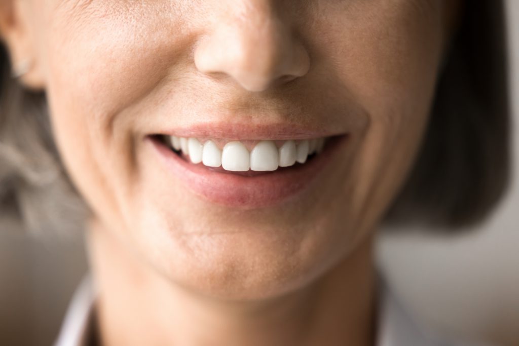 Close Up Of Beautiful Woman Smile After Teeth Whitening Procedure