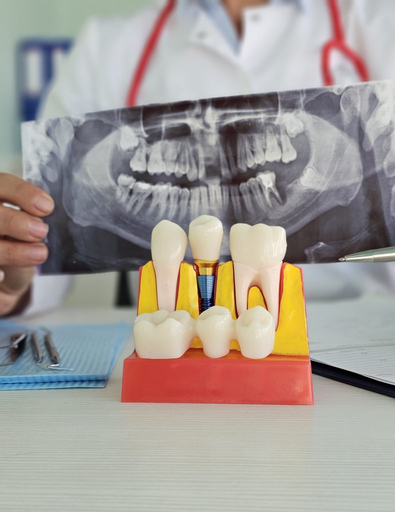 X Ray Of A Human Jaw In The Hands Of The Dentist Closeup